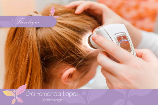 A importância da avaliação dermatológica na queda de cabelos