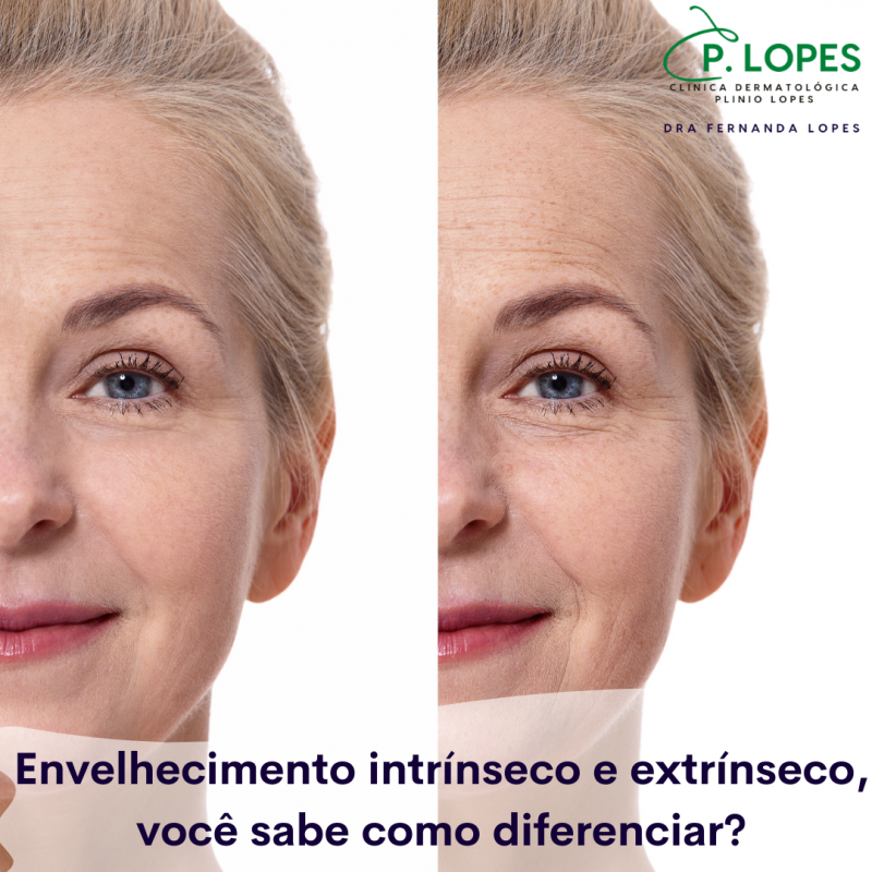 Dra Fernanda Lopes Dermatologia Blog Envelhecimento Intrínseco E