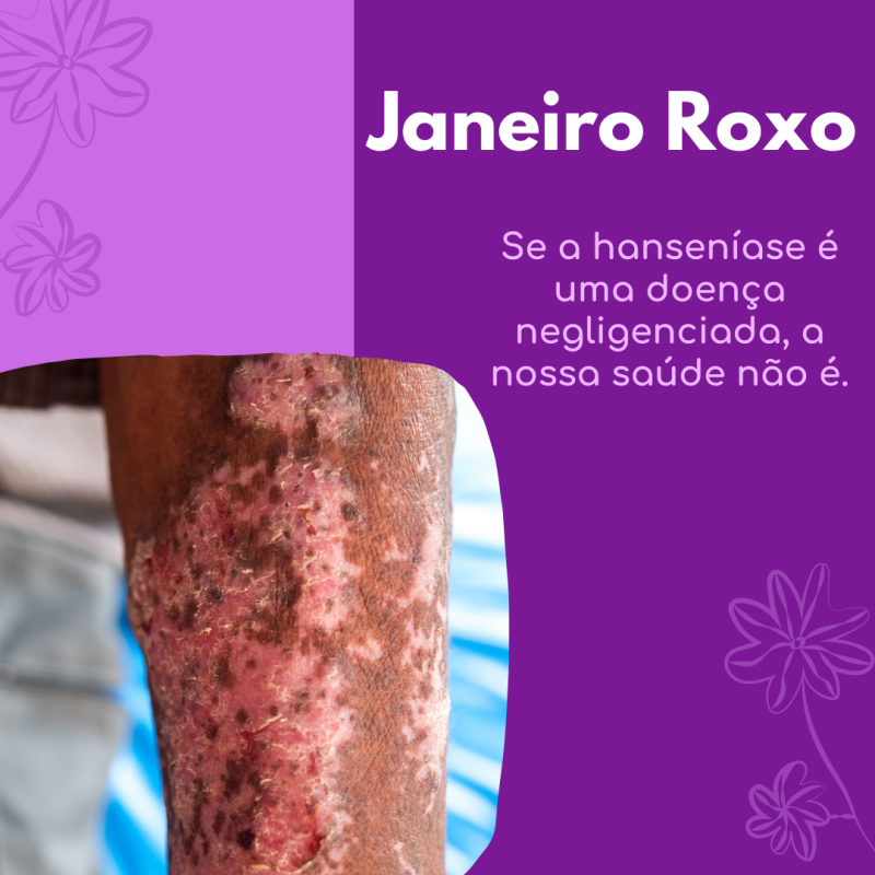 Dra. Fernanda Lopes Dermatologia - Blog - Janeiro Roxo - Hanseníase